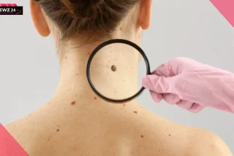 Skin Cancer की ओर इशारा करते हैं त्वचा में होने वाले ये बदलाव