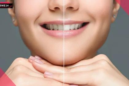 Teeth Whitening Tips इन नुस्खों से पाएं चमकदार दांत