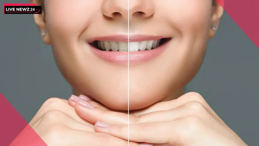Teeth Whitening Tips इन नुस्खों से पाएं चमकदार दांत